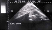 Ultrasonography
